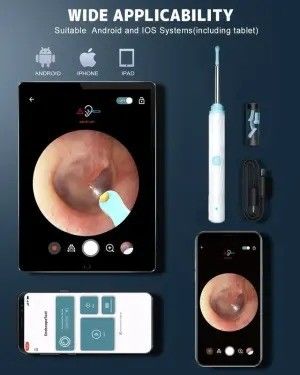 مجموعة إزالة شمع الأذن للمنظفات المنزلية مع 1296P Otoscope Ear Cleaner Camera and Light